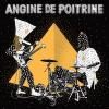 Angine de Poitrine